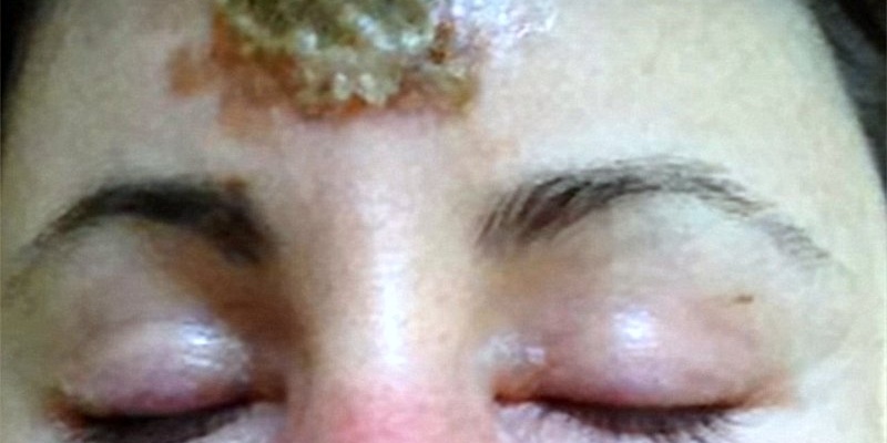 crni-melem 11.1.2017. 11.1.2017. 23-09-16. 23-09-16