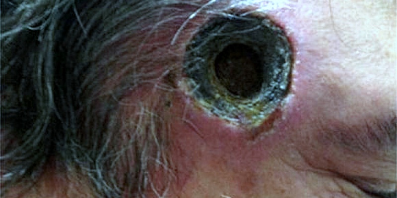 crni-melem 11.1.2017. 23-05-04