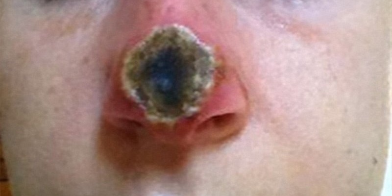 crni-melem 11.1.2017. 23-09-017