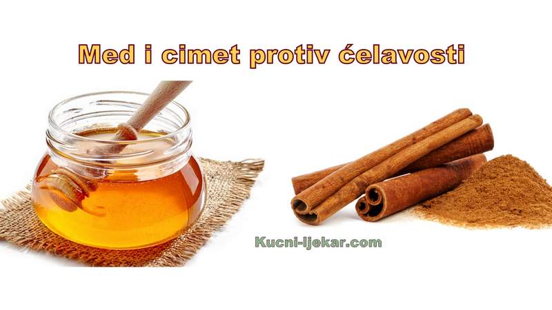 Kako izliječiti ćelavost